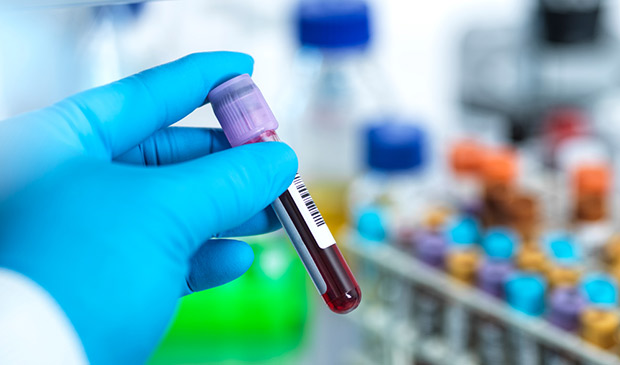 A gloved hand holding a vial of blood